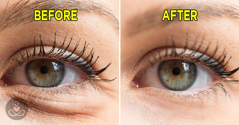 7 Simple Ways to Naturally Reduce Wrinkles