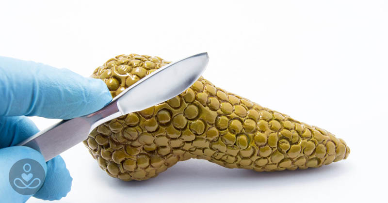 Why Pancreatic Cancer Is On the Rise