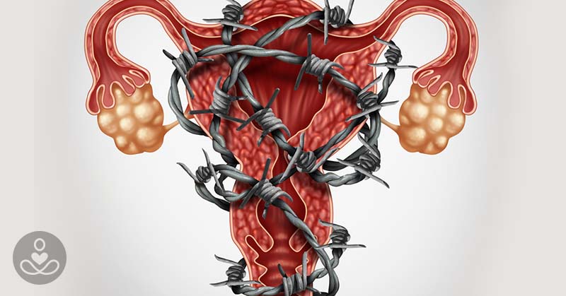 Study: Endometriosis Sufferers More Likely to Develop Heart Disease