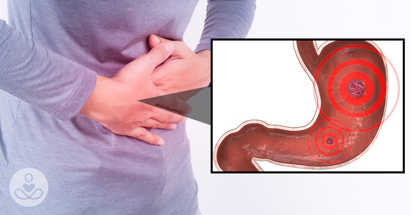 Early Symptoms of a Stomach Ulcer That Shouldn’t Be Ignored