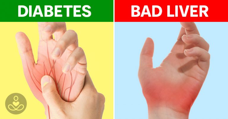 8 Signs to Look Out For in Hand Pain and Problems - Featured image
