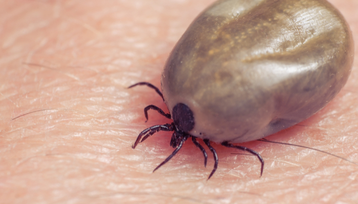 A photo of a tick bloated with human blood.