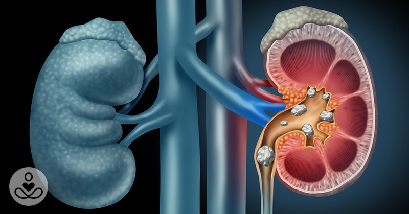 10 Habits That Can Seriously Damage Your Kidneys