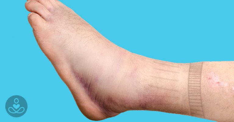 11 Strange And Surprising Signs Of Heart Disease You Need To Know About - Featured image