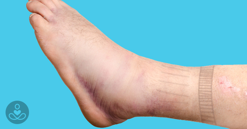 11 Strange And Surprising Signs Of Heart Disease You Need To Know About