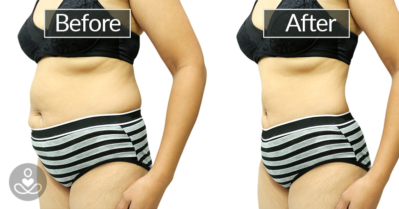 This Woman Got Rid of Her Bloated Belly By Changing These 6 Things