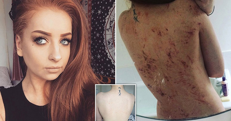 How A Dietary Change Became One Woman’s Long Searched Answer For Eczema