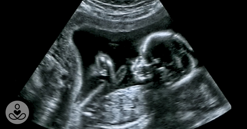 Scientists May Have Actually Found One Of The Causes Of Autism