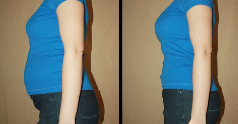 Fodmaps Diet: If Chronic Bloating or IBS Is Ruining Your Life, Try This - Featured image