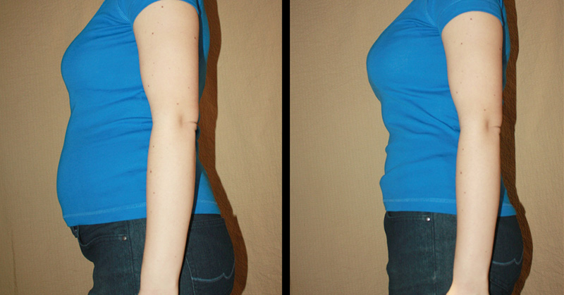 Fodmaps Diet: If Chronic Bloating or IBS Is Ruining Your Life, Try This