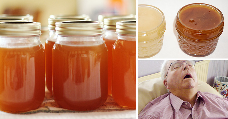 Snoring Remedy: You Can Make This Anti-Snoring Jelly in 7 Minutes