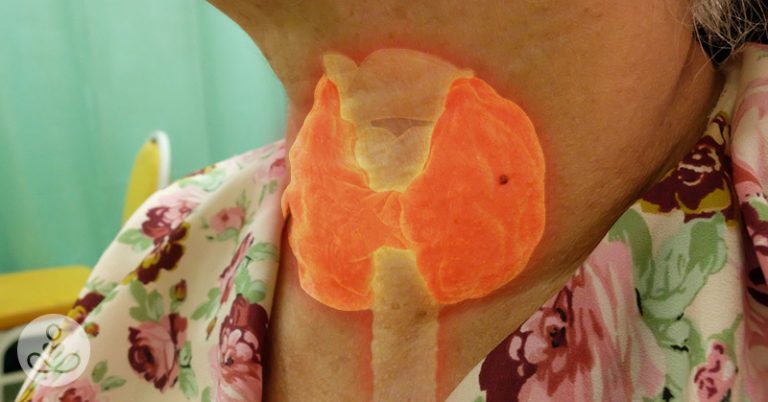 11 Warning Signs Your Body Is Suffering from Iodine Deficiency - Featured image