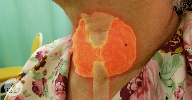 11 Warning Signs Your Body Is Suffering from Iodine Deficiency