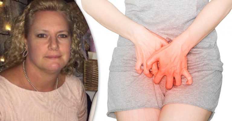 Vulvar Cancer: How One Mom’s Skin Condition Turned into a Dangerous Cancer - Featured image