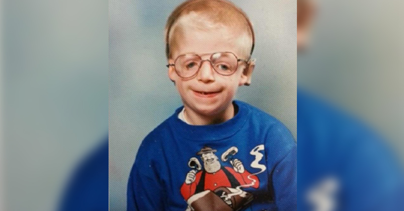 How Jono Lancaster Embraced Treacher Collins Syndrome and Is Inspiring Others