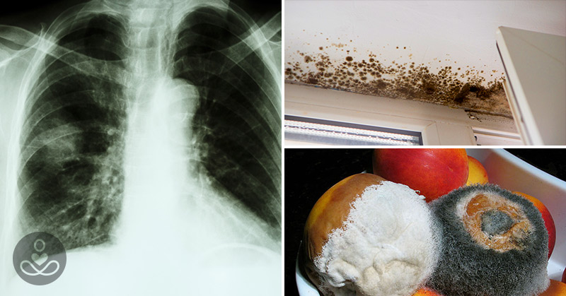 15 Warning Signs Mold Hiding In Your Home and Could Be a Risk to Your Health