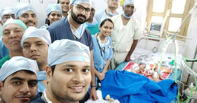 Surgeons Separate Conjoined Twins for Free Because Parents Couldn’t Pay