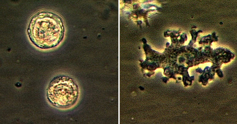 Rare Brain-Eating Amoeba Turned Woman’s Brain Into ‘Mush’ While She Was Still Alive