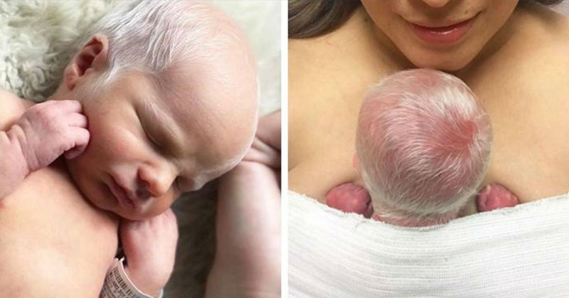 I Gave Birth to the Babies With ‘White’ Hair & This Is What I Need You to Know
