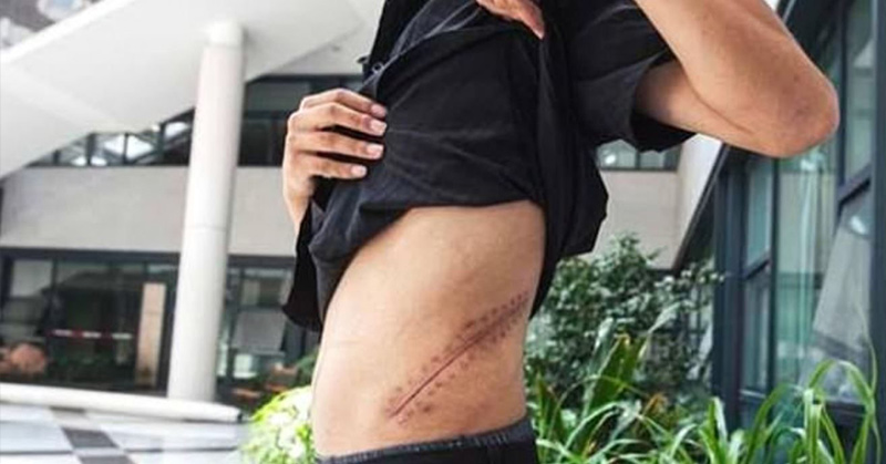 Teenager Bedridden for Life After Making a Sale on the Black Market to Afford The Latest Apple Products