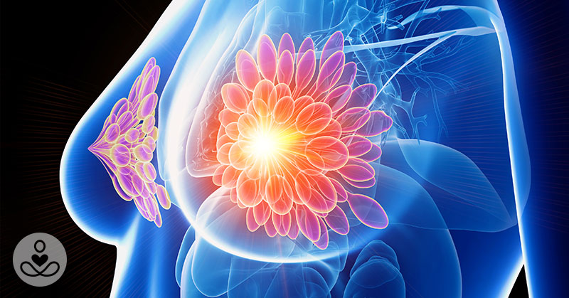 Researchers Treat HER2-Positive Breast Cancer Without Chemo
