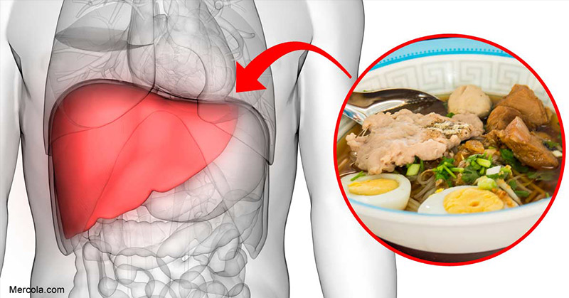Choline Deficiency Can Trigger Fatty Liver Disease
