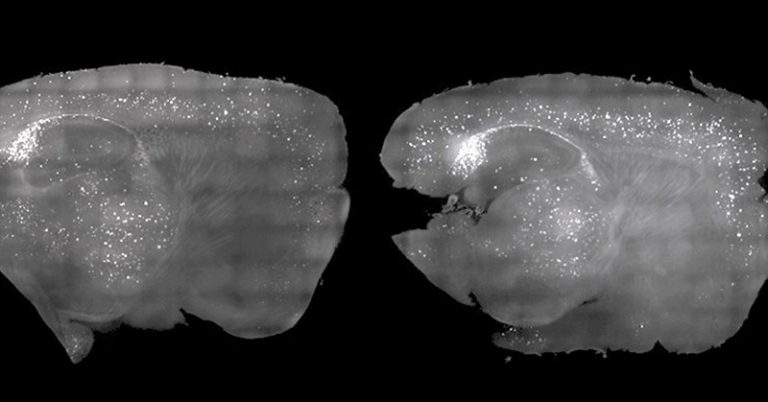Light and Sound Therapy Shows Potential for Treating Alzheimer’s Disease - Featured image