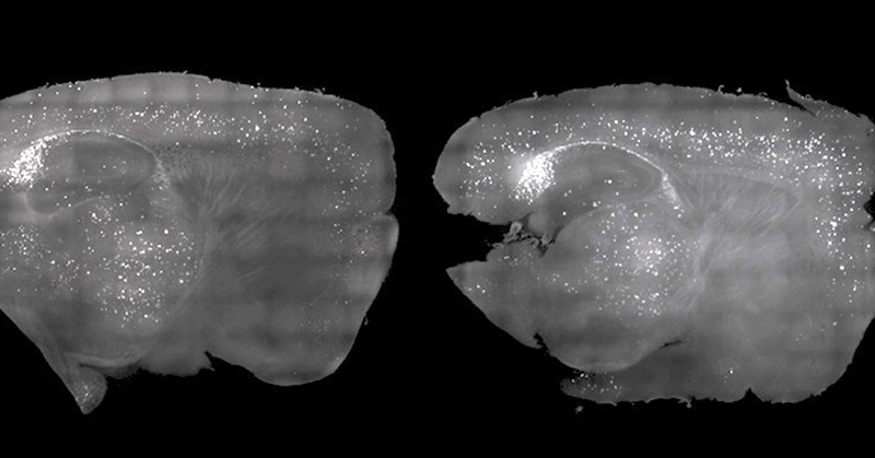 Light and Sound Therapy Shows Potential for Treating Alzheimer’s Disease