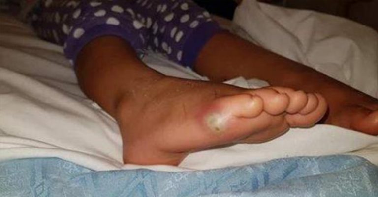 4-Year-Old Catches Sepsis While Trying On New Shoes without Socks - Featured image