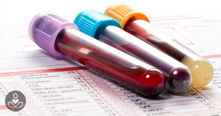 Blood Test May Be Able to Diagnose Fibromyalgia - Featured image