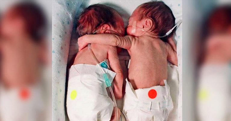 Nurse Places Dying Newborn next To Her Twin, Ends up Giving Her a Hug That Saves Her Life - Featured image