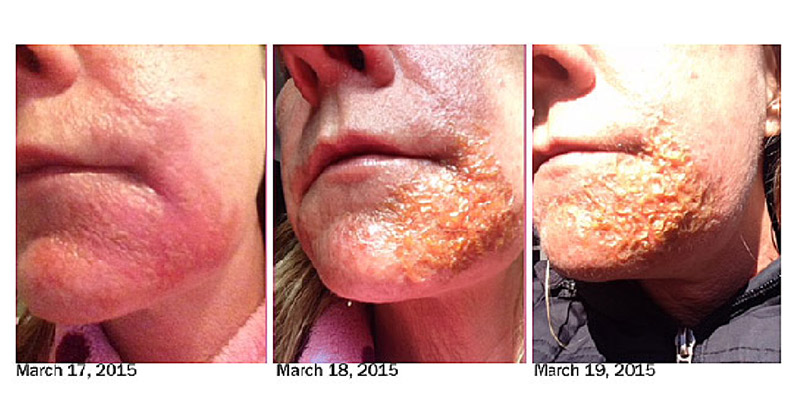 Are Essential Oils Risky? What to Be Aware Of, And Use Best Practices