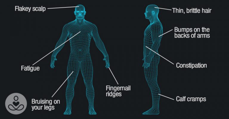 10 Signs Of A Vitamin Deficiency And What To Do About It - Featured image
