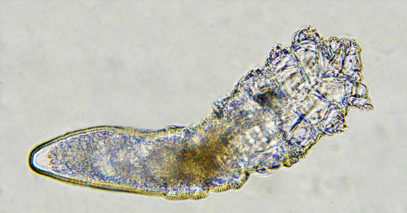 Apparently, Tiny Mites Live on Everyone’s Face, Including Yours