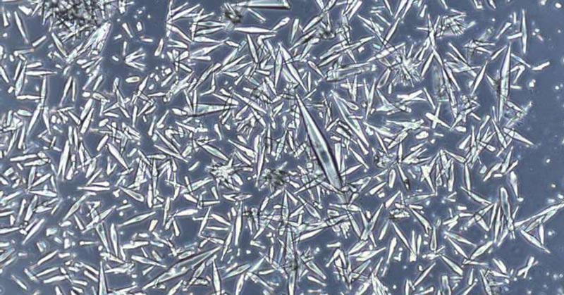 Scientists Solve a Century-Old Mystery to Treat Asthma and Airway Inflammation