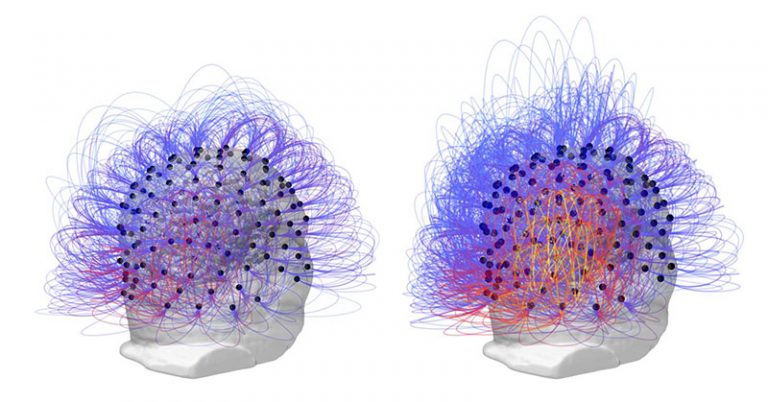 Researchers Restored Consciousness In A Man Who Spent 15 Years In A Vegetative State - Featured image