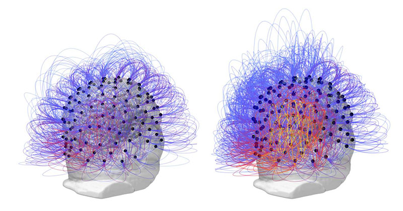 Researchers Restored Consciousness In A Man Who Spent 15 Years In A Vegetative State