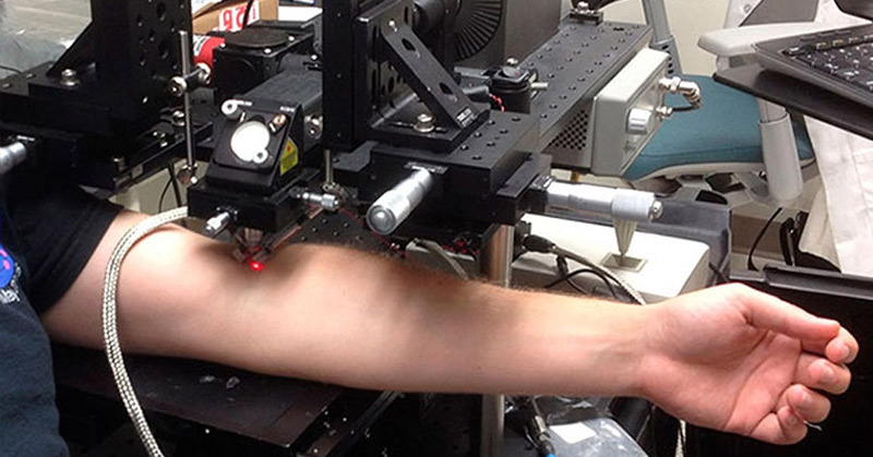 Laser Destroys Cancer Cells Circulating in the Blood