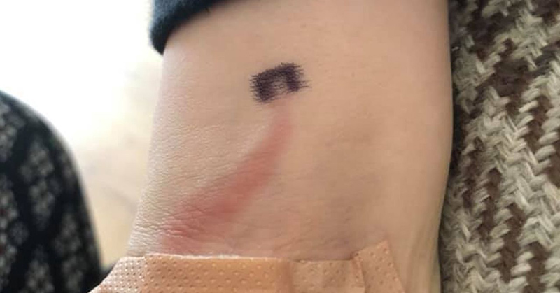 Mom Saves Son’s Life After Recognizing Signs of Sepsis