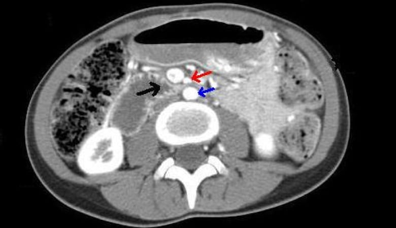 brains scan showing points of concern