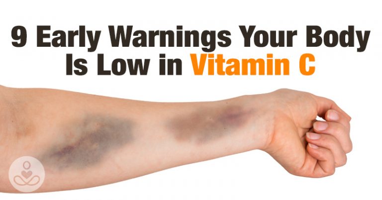 9 Early Warning Signs Your Body is Low in Vitamin-C - Featured image