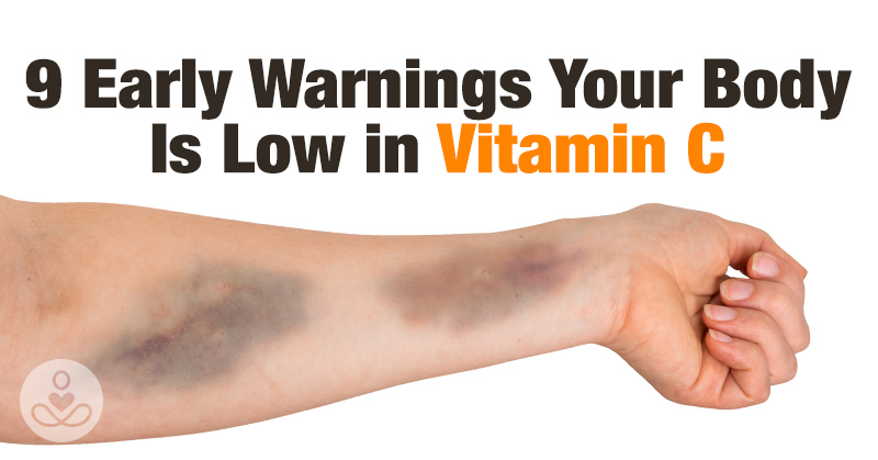9 Early Warning Signs Your Body is Low in Vitamin-C