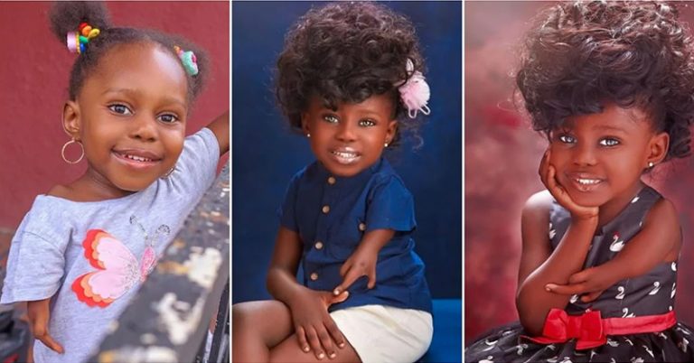 Mom Shares Lovely Photos Of Daughter Born With a Unique Arm - Featured image