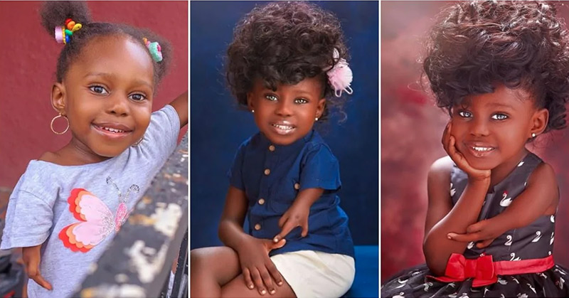 Mom Shares Lovely Photos Of Daughter Born With a Unique Arm