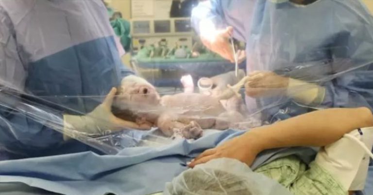 What Expecting Parents Should Know About the “Gentle” C-Section - Featured image