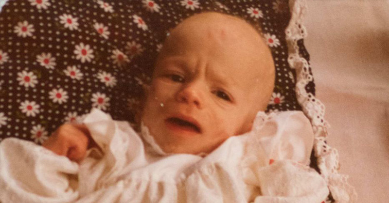 33 years On, This Father Still Fights For His Daughter After Shocking Diagnosis