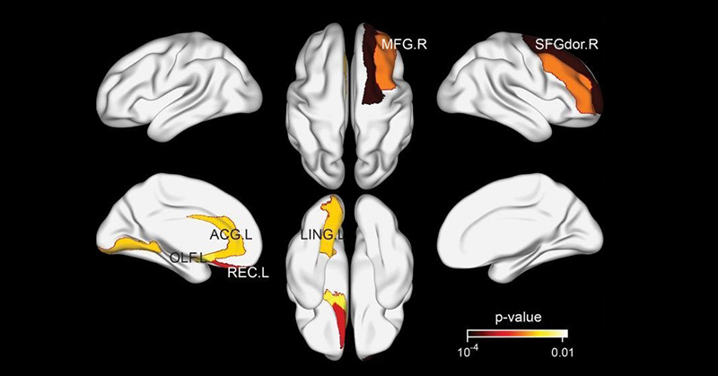 Does Tea Equal a Healthier Brain? Research Points to Yes