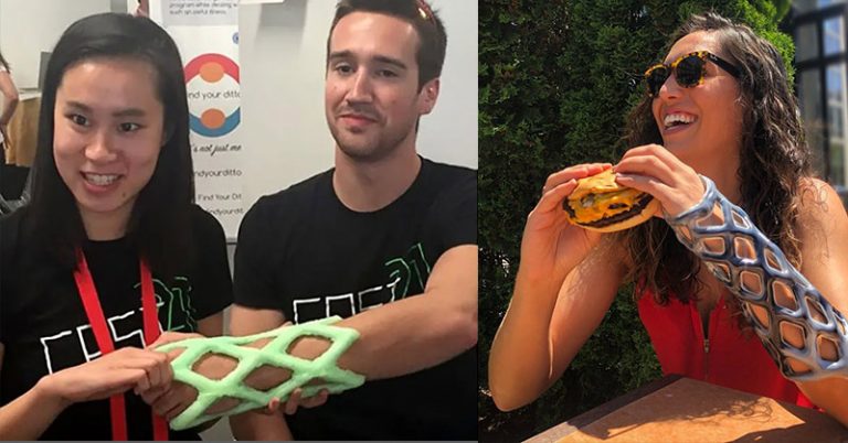 Engineering Students Create Waterproof and Lightweight Arm Cast with Aim to Replace Plaster Casts - Featured image