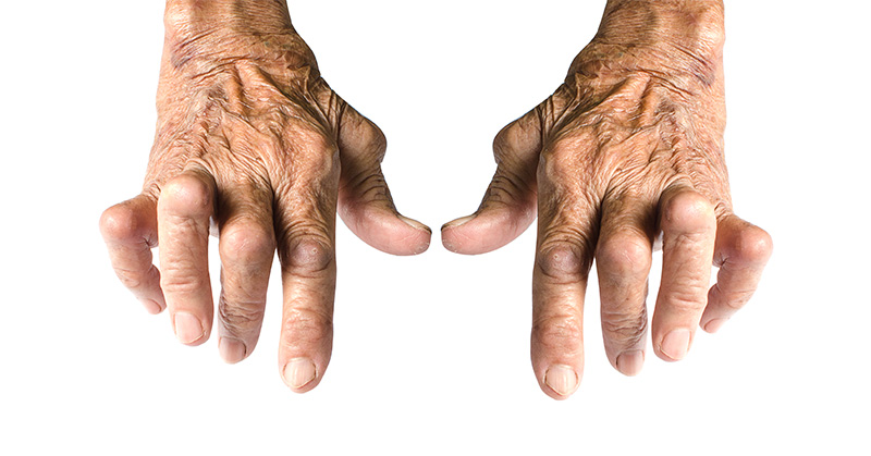 The Cause Of Autoimmune Diseases Like Rheumatoid Arthritis Could Be In Your Fridge