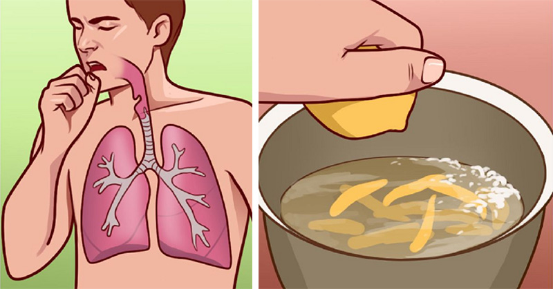 10 home remedies to help with bronchitis and painful coughing attacks